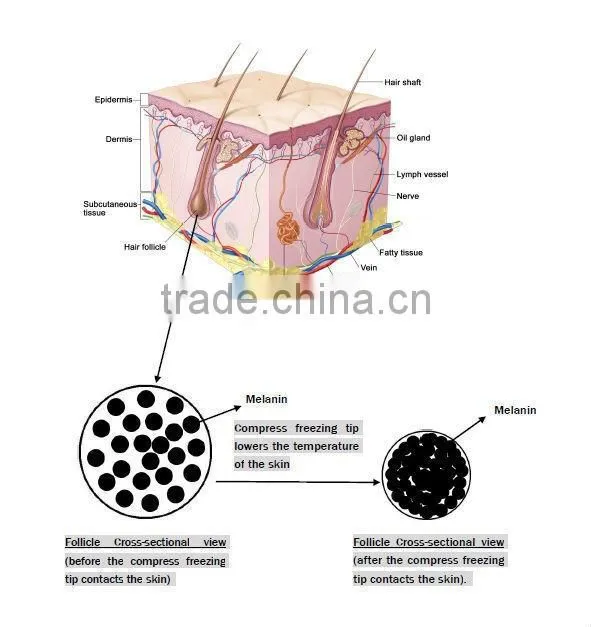 permanent treatment popular ipl pulsed light hair removal equipment