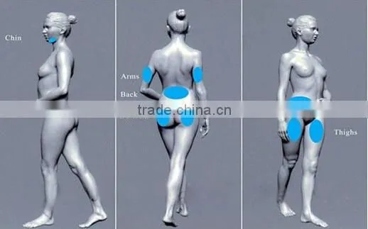 2015 new slim freezer weight loss / fat freeze belt/cool tech fat freezing machine