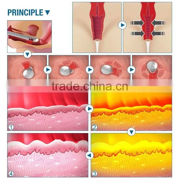 Best promotion price/fractional co2 laser/co2 fractional laser/laser equipment co2 fractional for vaginal tightening