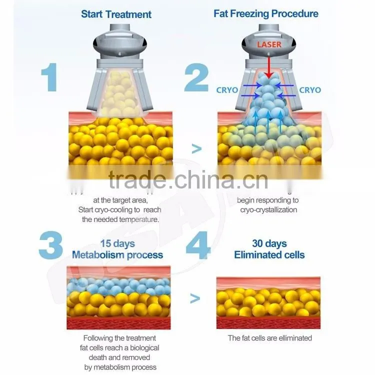 Spa use machine for body scupture fat removal slimming cryolipolise