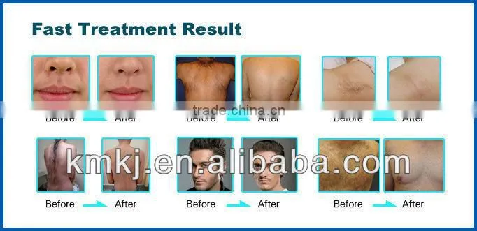 Safety and economical electronic multifunction beauty equipment