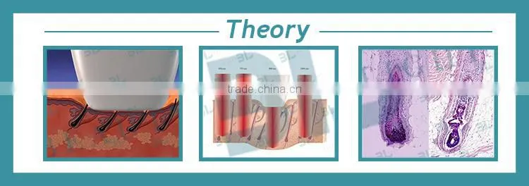 lightsheer diode laser system, laser hair removal best machines, hair laser