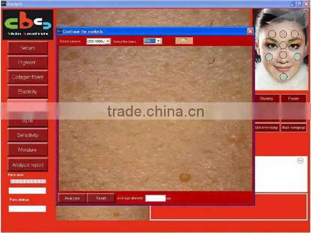 professional made in Taiwan skin magnifier portable skin analysis equipment