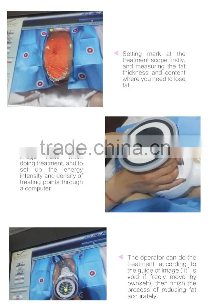 Permanent Body Slimming Ultrashape/Best slimming machine Ultrashape/High Quality Ultrashap machine for salon