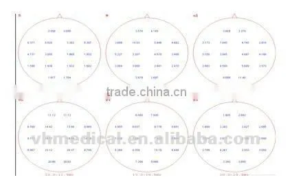 EEG device 24-channel portable machine
