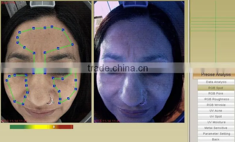 3d Facial skin analyzer machine with CE certification
