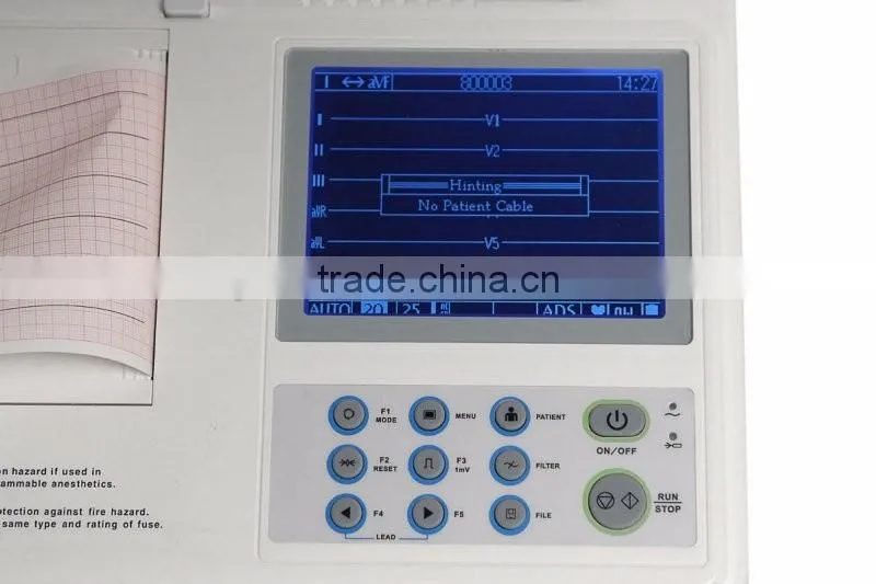 OEM Six channel digital ECG machine 12-lead Digital 6-channel Electrocardiograph