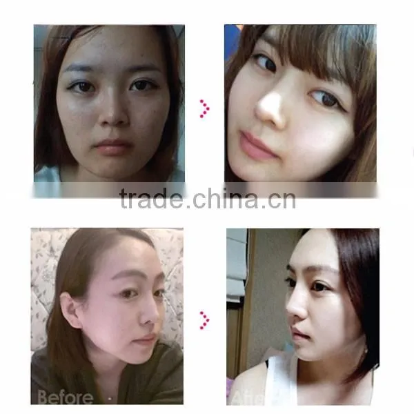 EYCO skin cleansing system anti wrinkle device beauty treatments LED EMS RF photon therapy beauty device
