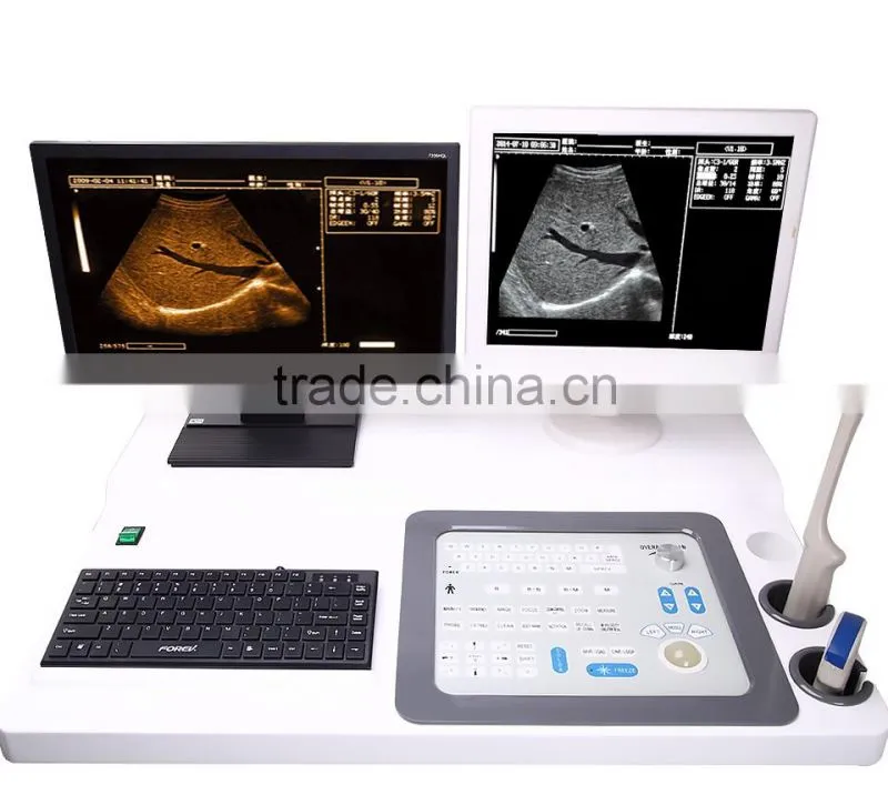 19"LCD ultrasound scanner PRICE With high-end color inkjet printer Display image in real time