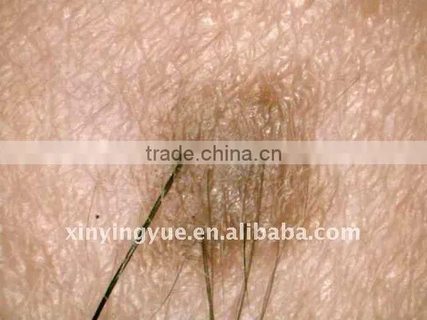 portable skin and hair analyzer equipment