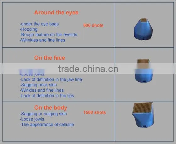 Facial resurfacing acne scar removal treatment fractional rf