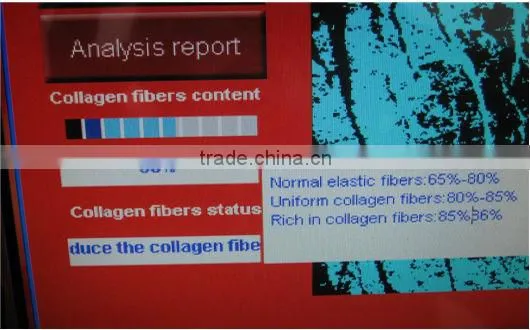 Auto-digital top CBS skin and hair analyzer