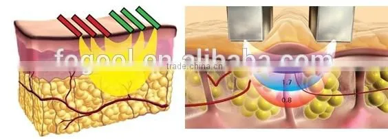 portable rf radio frequency facial machine beauty products