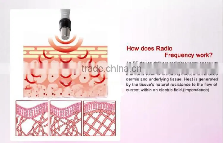 T&B 3MHZ best home rf skin tightening face lifting machine