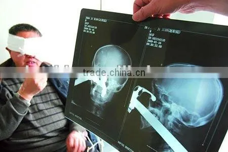 Imaging medical ray film,digital x-ray cr,fuji dry film with CE sale from manufacturer
