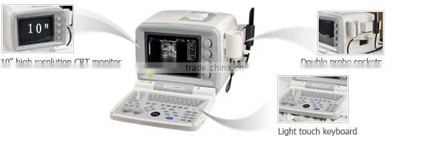Hot Sale cheap And Best Seller Portable Ultrasound Machine 2000G