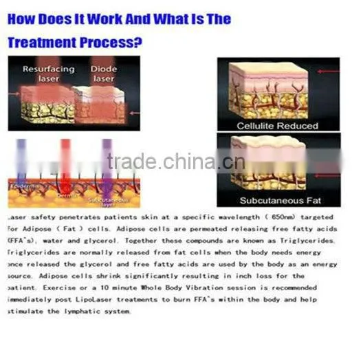 fast!!!hot sale!!!!14 pads portable lipo laser machine for sale