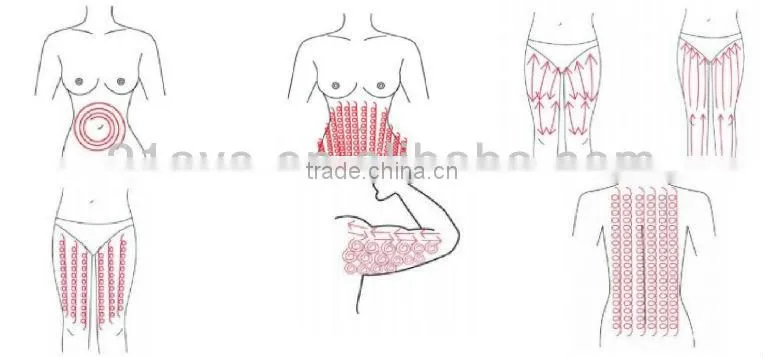 Hot Sale Cavitation and Vacuum RF Slimming Machine for Weight Loss