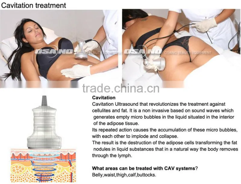 physical therapy equipments, Vela Shape Derma Vacuum Massage Therapy Equipment