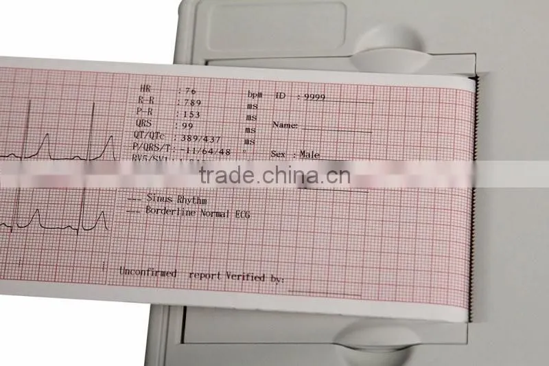 CE approved Three channel color LCD display 12-lead Built ECG Machine in USB/RS232 interface
