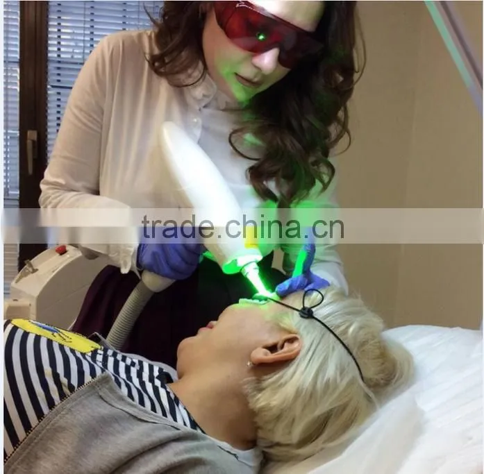 Sanhe ce 2 years warranty q switch nd yag laser tattoo removal medical laser nd yag equipment