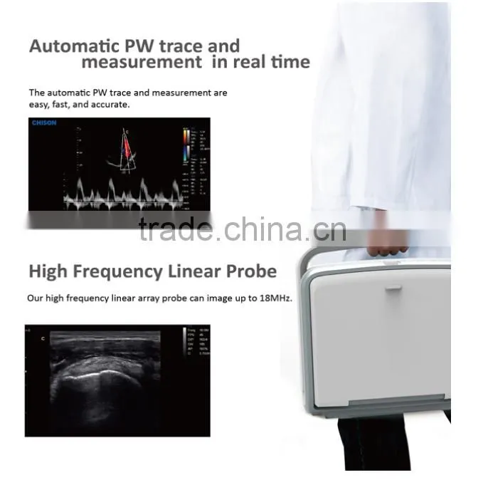 2016 new Portable Color Doppler(Optional 4D) for cardiac use