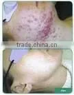 Hight quality IPL beauty machine A003 at Low price