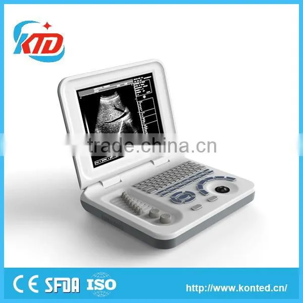 Portable Ultrasonic Diagnostic Devices , Laptop Portable Ultrasound Machine & Ultrasound Scanner