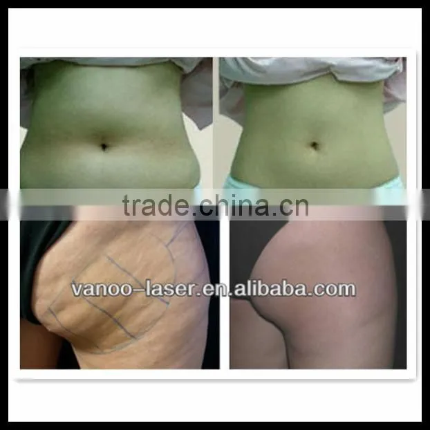 Factory directly weight loss equipment for sale