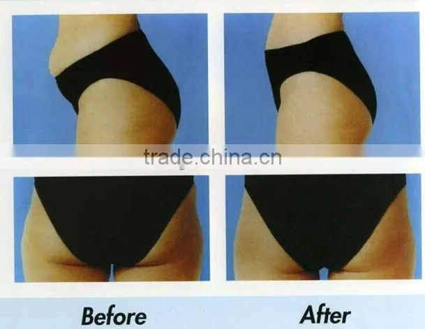 latest professional Ultrasonic liposuction cavitation slimming machine for wholesale