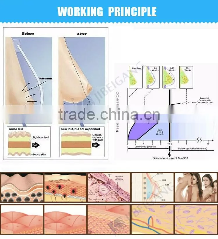 Home use add vaccum breast cupping massage breast care equipment