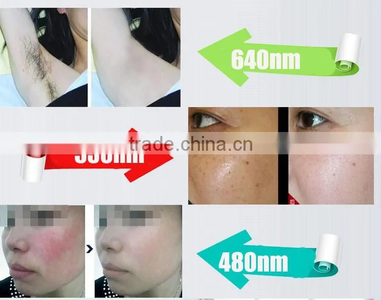 multifunctional ipl beauty machine/opt elight laser hair removal/freckle removal machine