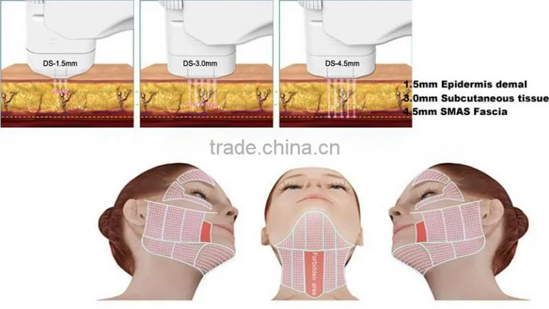 HOT!!! 2016 Lowest Price HIFU Machine Vaginal Hifu Anti-wrinkle Vaginal Tightening Machine for Beuaty Spa