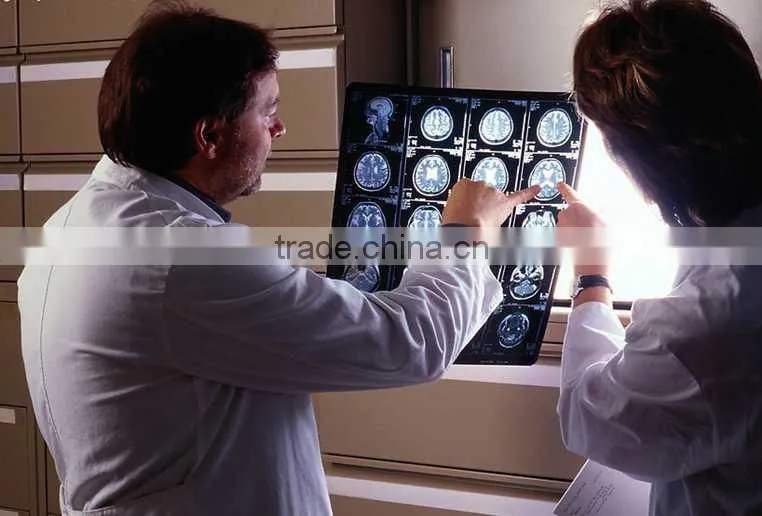 Konida medical x-ray film agfa fuji dry film/x-ray automatic medical film processor
