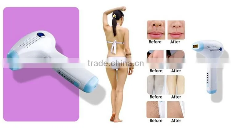 2016 best seller DEESS hair removal with 300,000 lamp life home use IPL beauty device