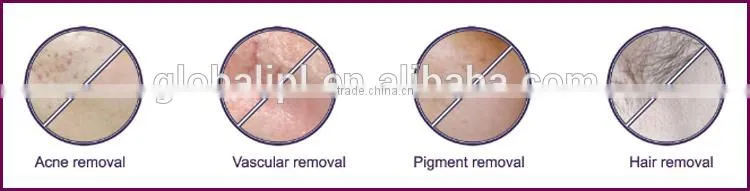 multifunction skin care acne treatment ipl hair removal machine home use