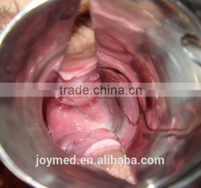 Self Exam Colposcope