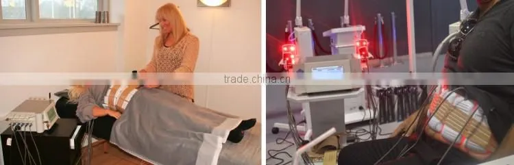 LP-03 Hot Sale Best Price 650 nm Slimming Laser Liposuction Machines For Home Use