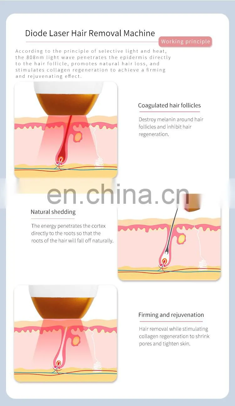 Factory price A-lma 755 808 1064 Diode Laser Hair Removal Beauty instrument Mixed 3 wavelength Suitable for all skin tones