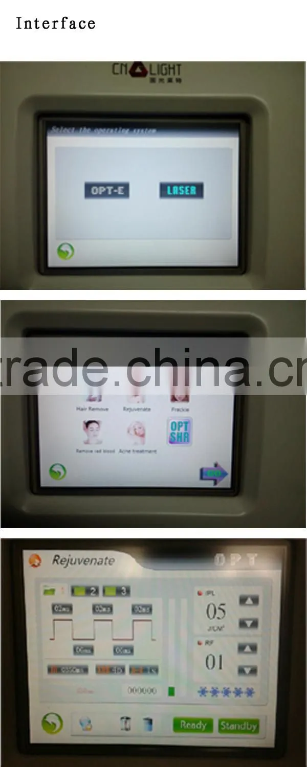Nd Yag laser ipl saloon beauty machine hand
