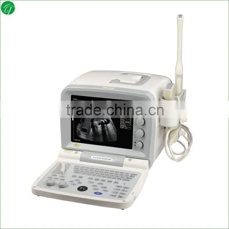 Full Digital B mode portable pregnancy ultrasound scanner Diagnostic Instrument
