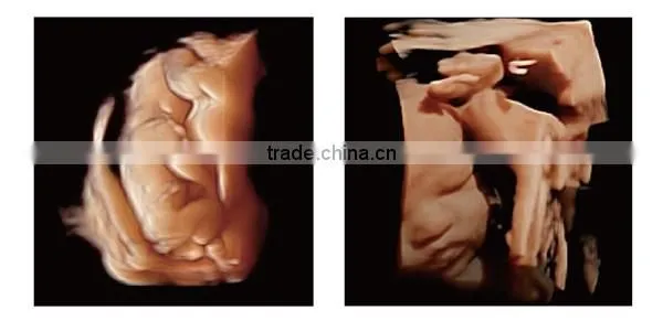 CE ISO approved medical 15 inch LCD Monitor 3D 4D trolley color doppler ultrasound scanner