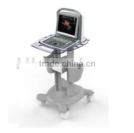 New Laptop 3D/4D Color Doppler Ultrasound System Ultrasound Color Doppler Portable