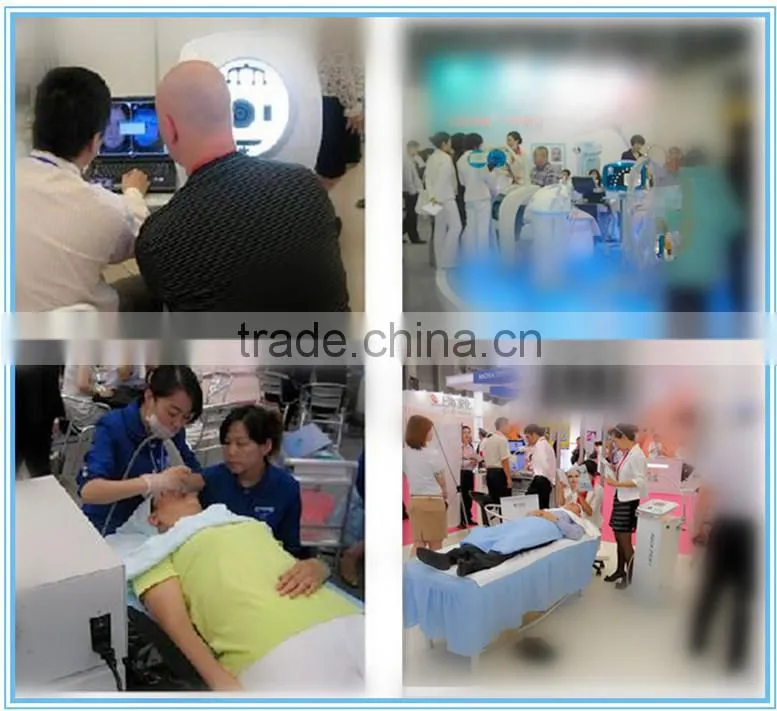 Professional Q switch nd yag laser tattoo removal system