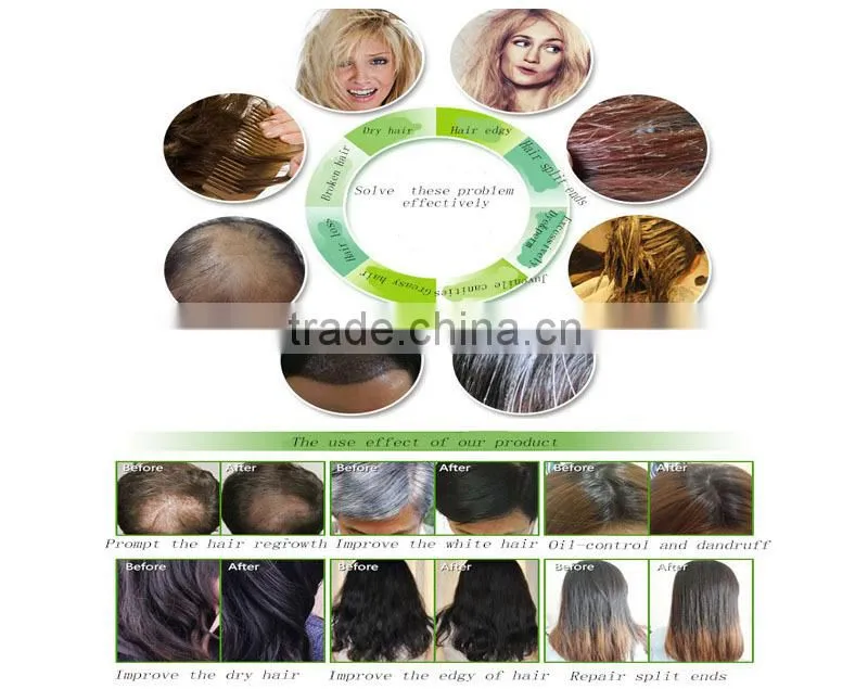 china supplier hair loss treatment machine hair care comb