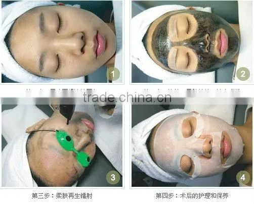 Best tattoo removal laser machine/portable personal laser depiladora