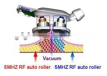 cavitation&radiofrequency&vacuum / ultrasonic cavitation for spa ,clinic