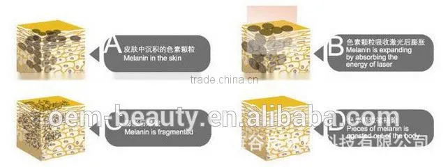 skin rejuvenation and permanent /painless tattoo removal machine