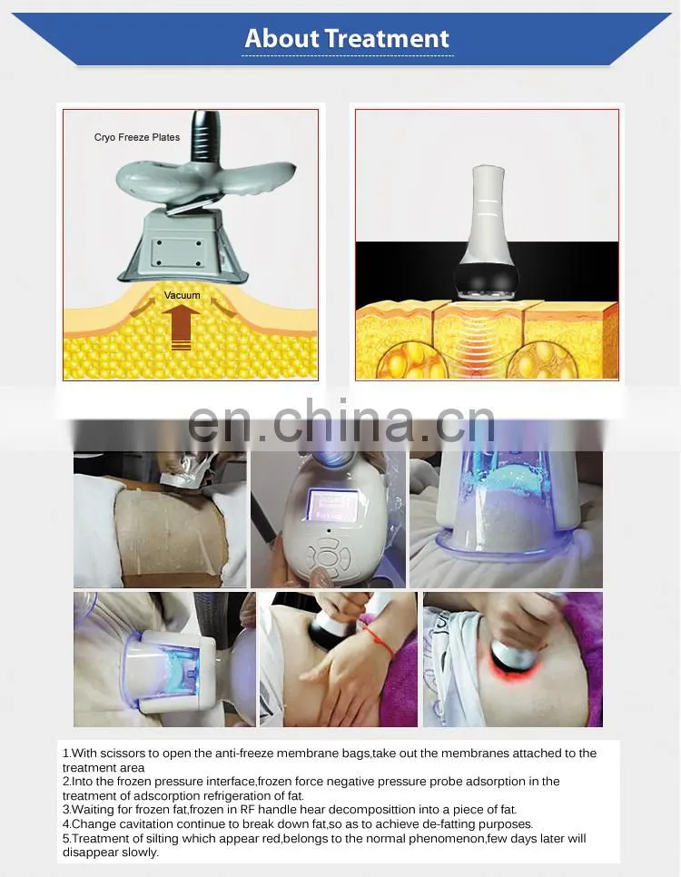Factory price cryo double chin reducer machine slimming equipment