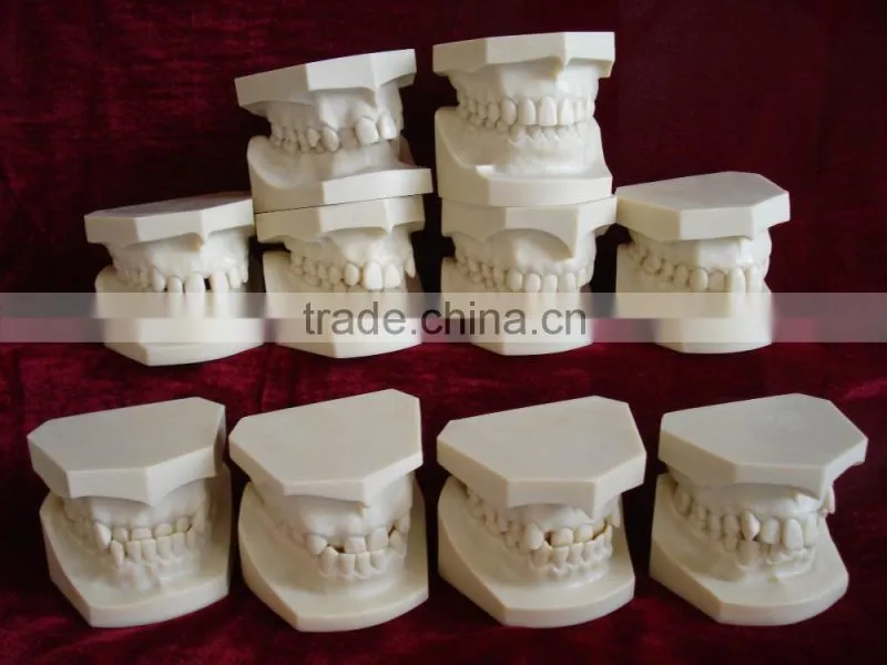 Malocclusion Classification Demonstration Model 2